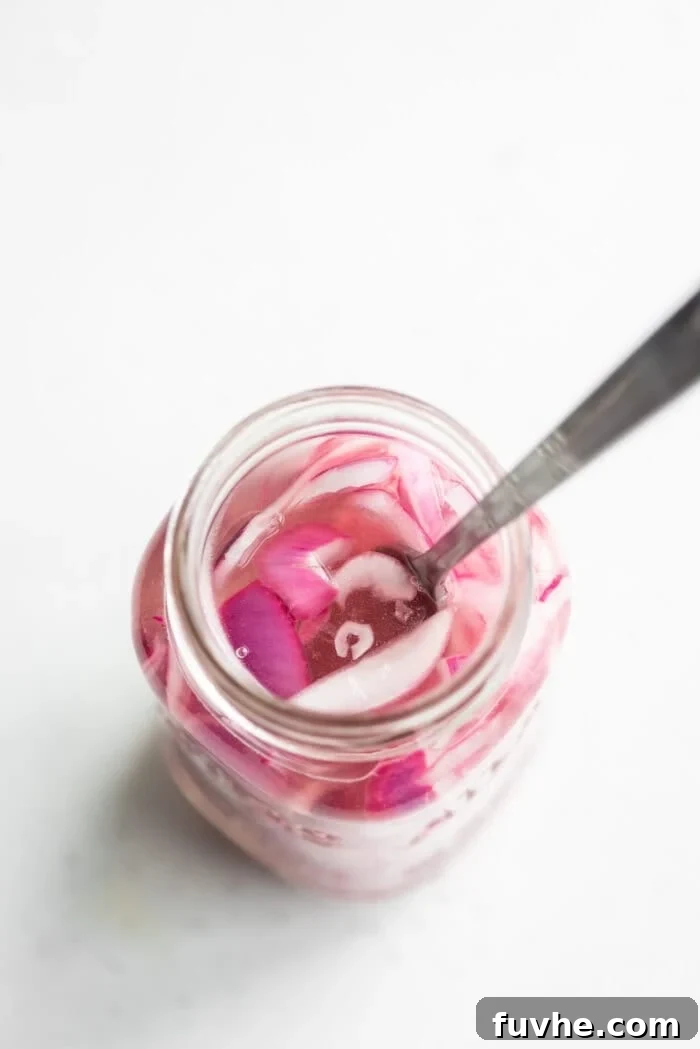 A jar of pickled red onions with a spoon being used to press down the onions.